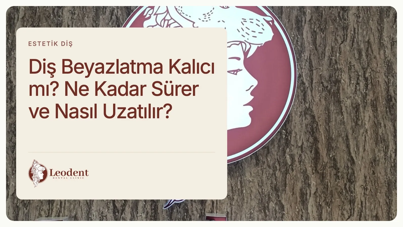 Diş Beyazlatma Kalıcı mı? Renk Neden Geri Döner?