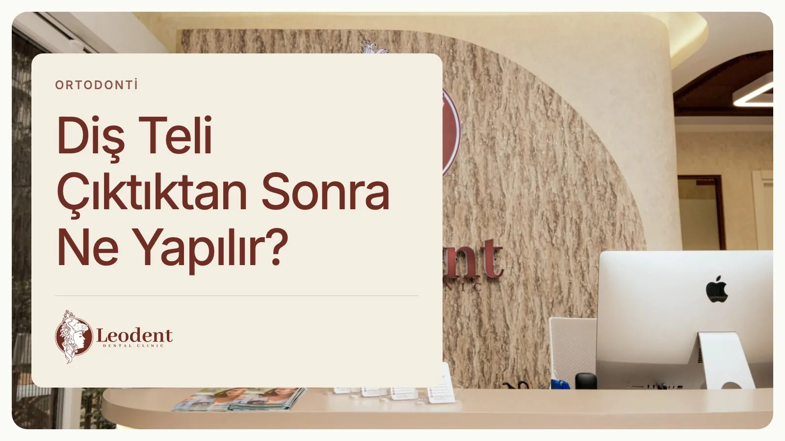 Diş Teli Çıktıktan Sonra: Pekiştirme ve Bakım