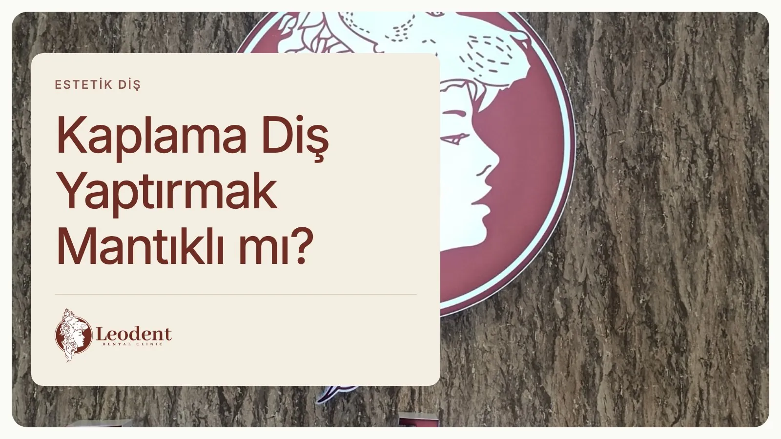 Kaplama Diş Gerekli mi? Karar ve Alternatifler