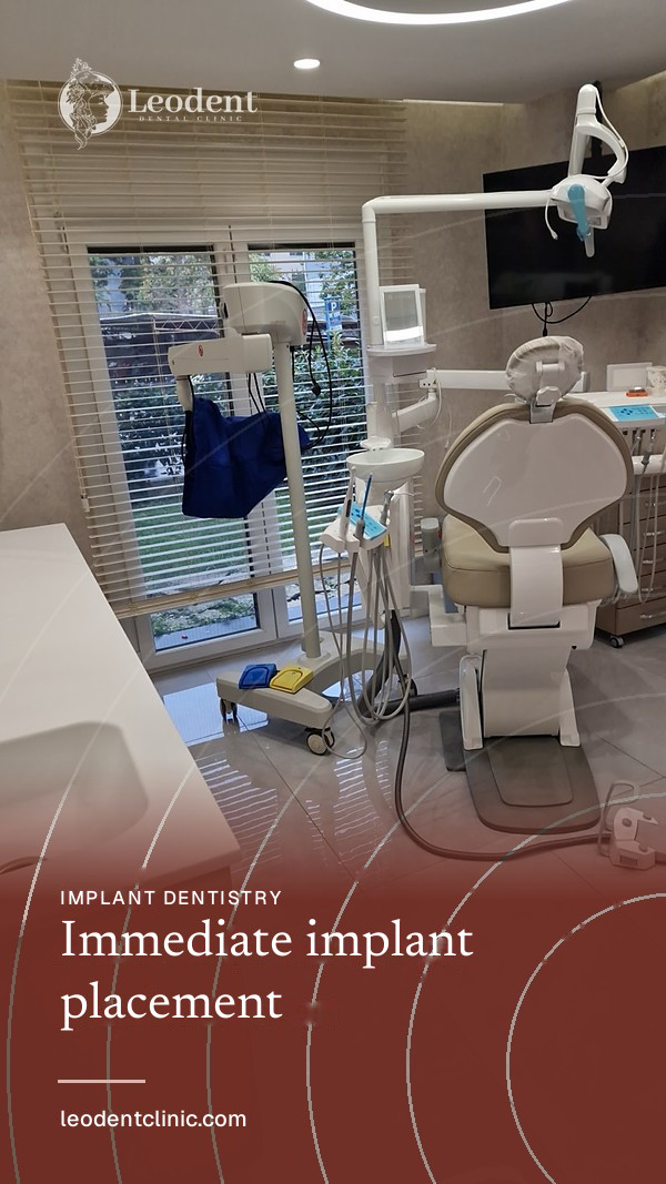 Immediate Implant Placement | Leodent Clinic