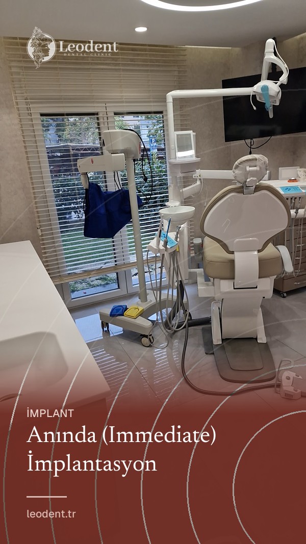 Anında (Immediate) İmplantasyon | Leodent Clinic