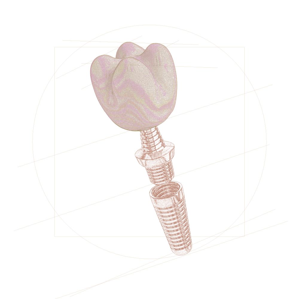 Leodent_Dental_Clinic_Bölümler_2025_Implant-min